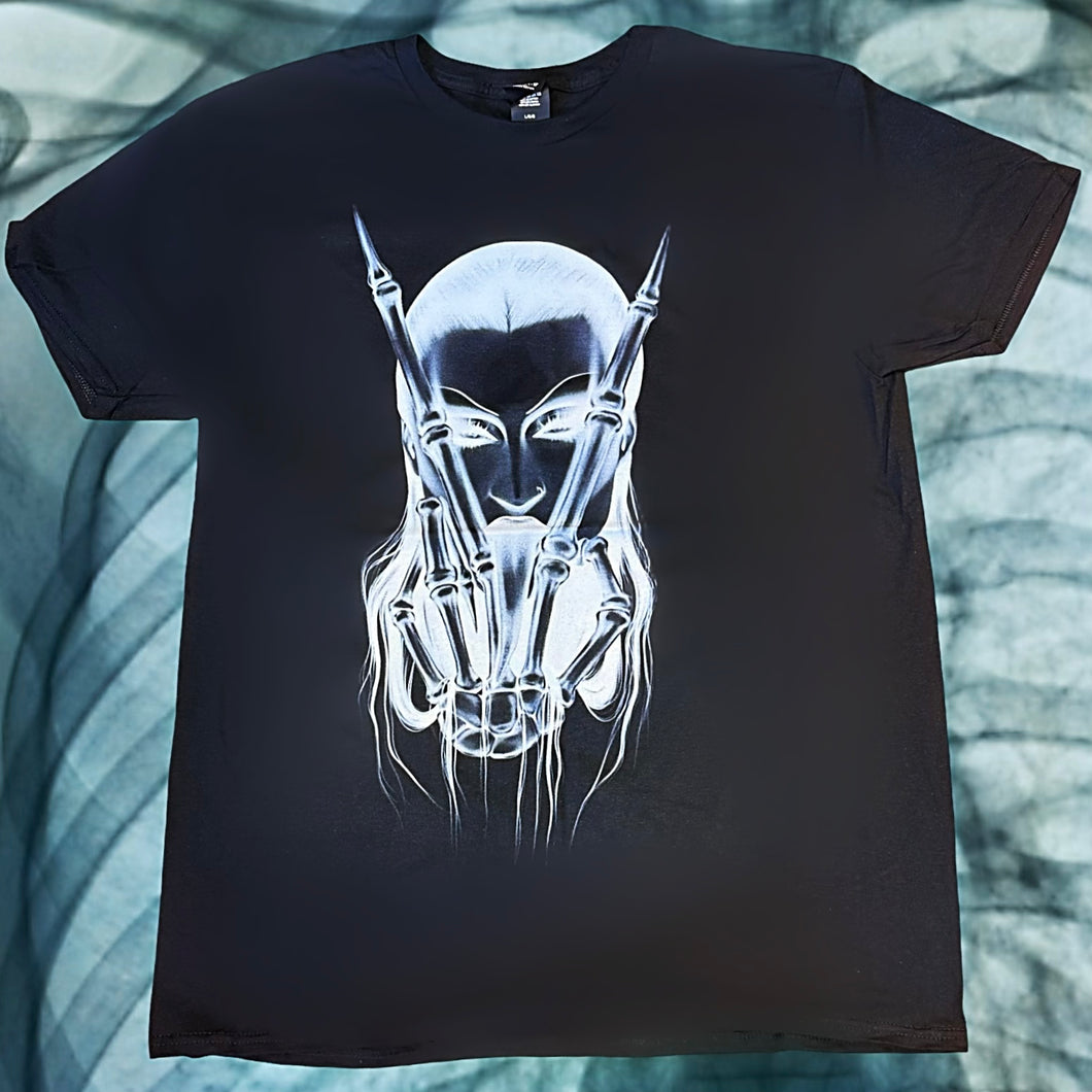 X Ray T